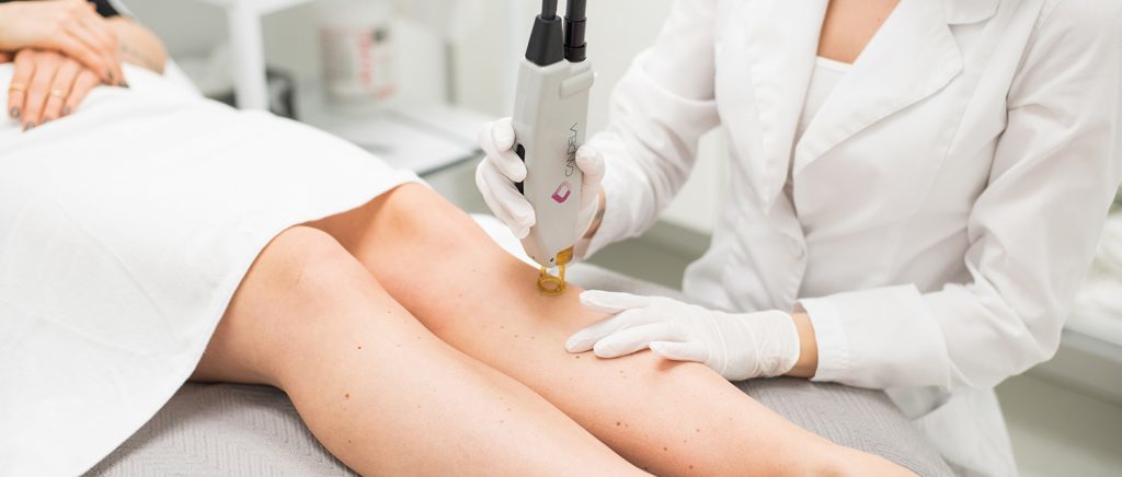 laser treatment malaysia